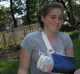 Als sie ihren Gips hatte